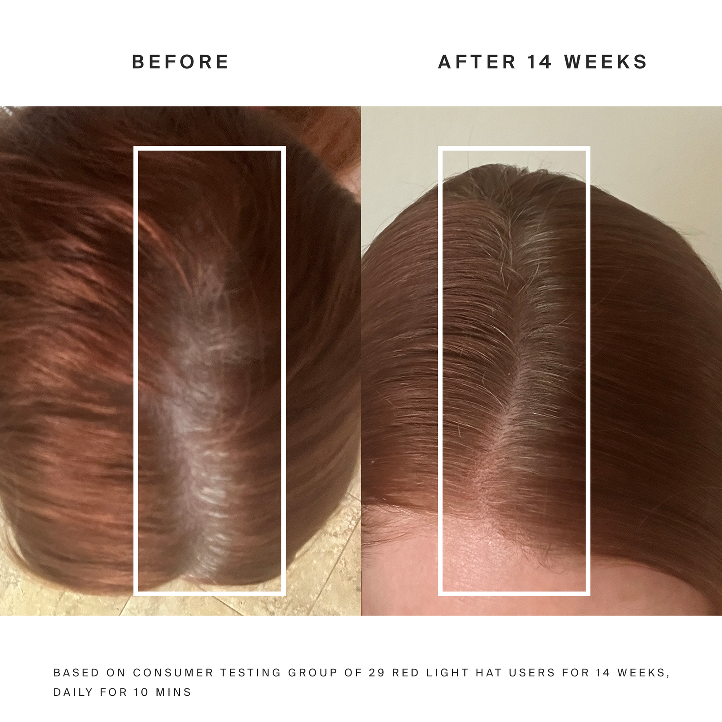 HigherDOSE Red Light Hat - REDHAT-V1