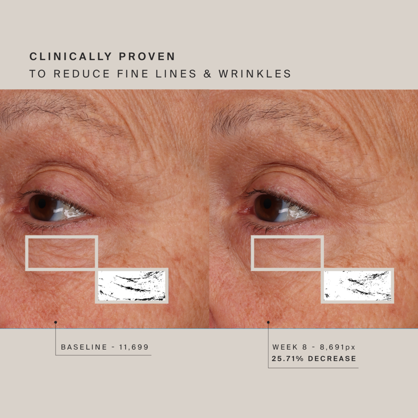 HigherDOSE Red Light Face Mask - MASK-V1